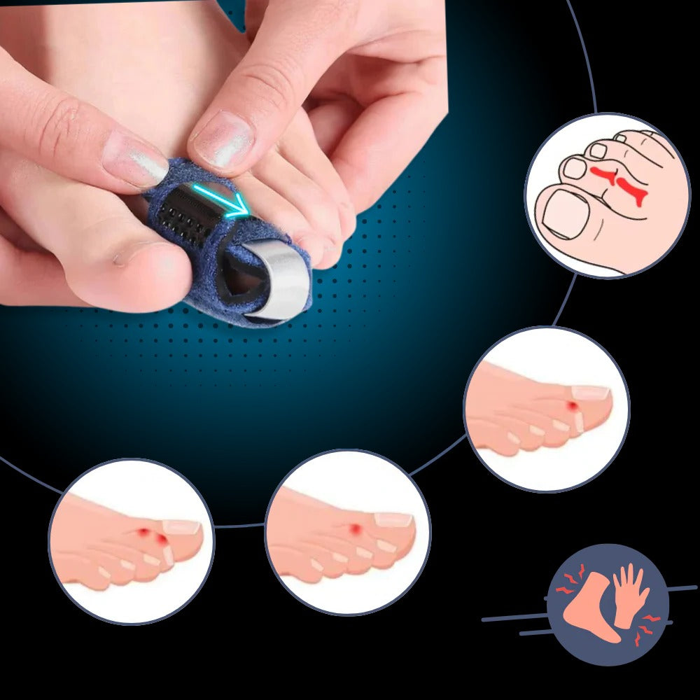 Adjustable Toe Straightener Comfort Support