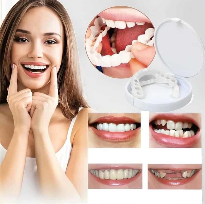Natural White Snap-On Teeth Veneers