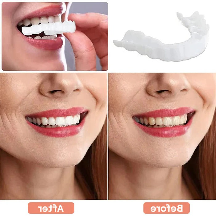 Natural White Snap-On Teeth Veneers