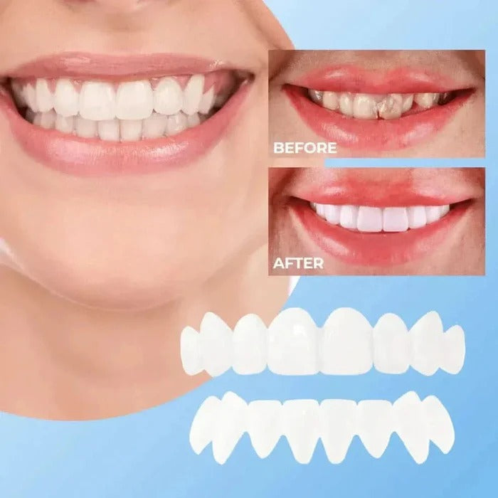 Natural White Snap-On Teeth Veneers