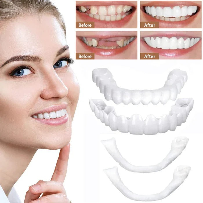 Natural White Snap-On Teeth Veneers