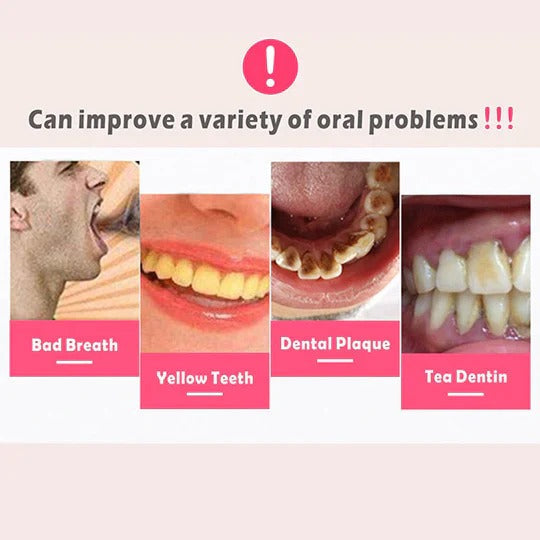 Dental Plaque Remover for Teeth & Gums
